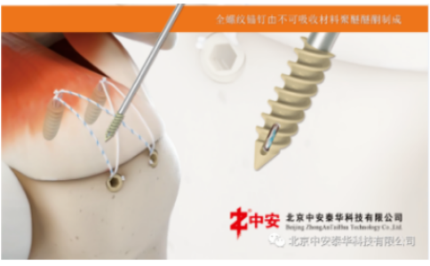 喜報！北京中安取得“聚醚醚酮帶線錨釘”注冊證！
